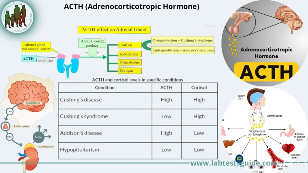 ACTH (Adrenocorticotropic Hormone)