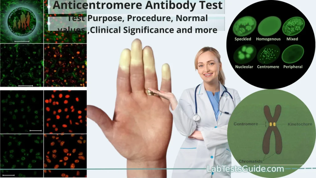 Anticentromere Antibody Test