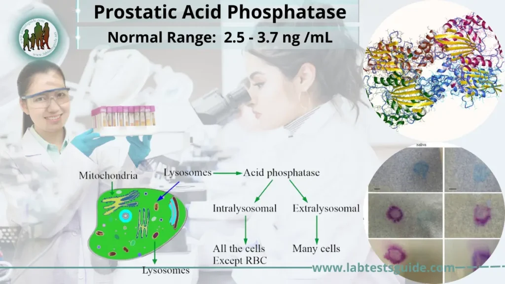 Prostatic Acid Phosphatase