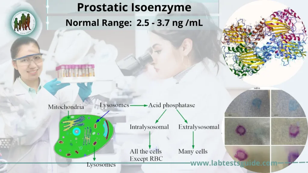 Prostatic Isoenzyme