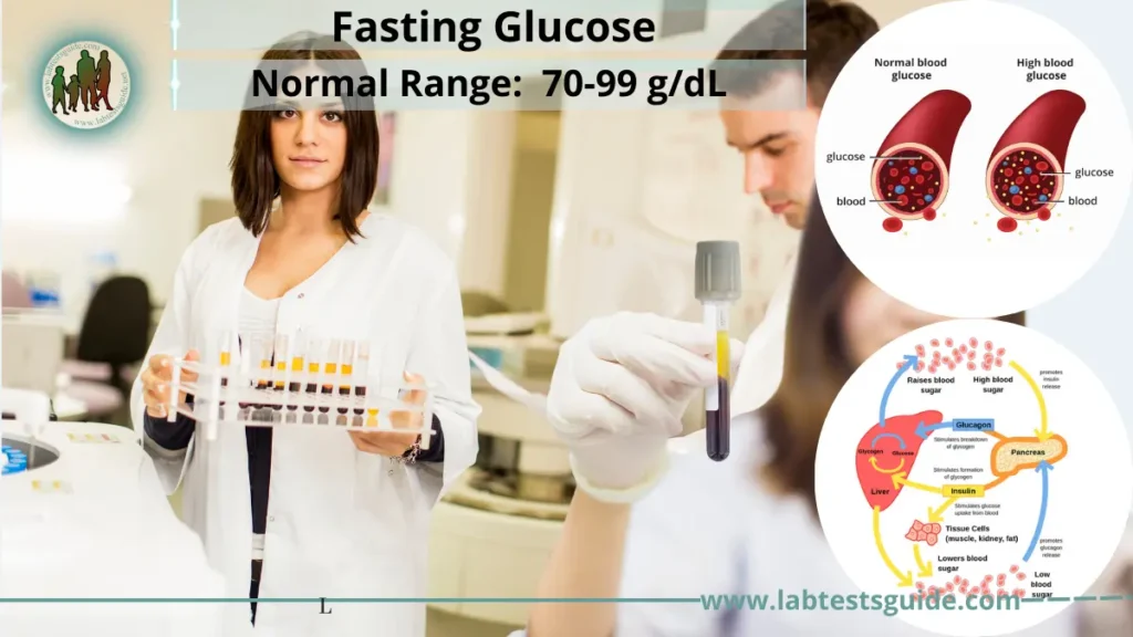 Fasting Glucose