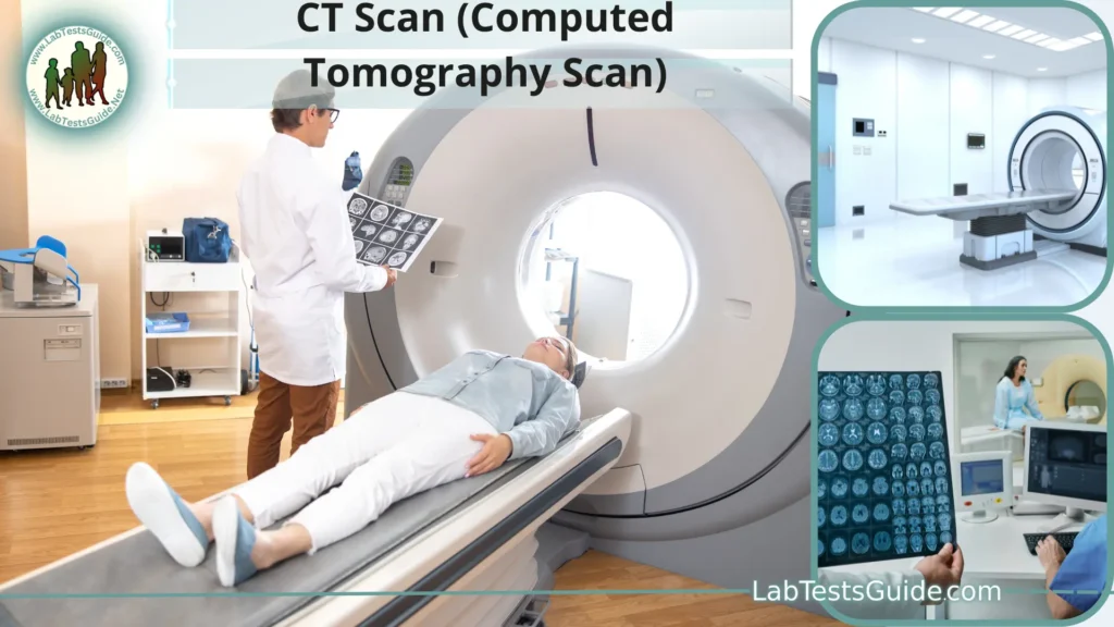 CT Scan (Computed Tomography Scan)