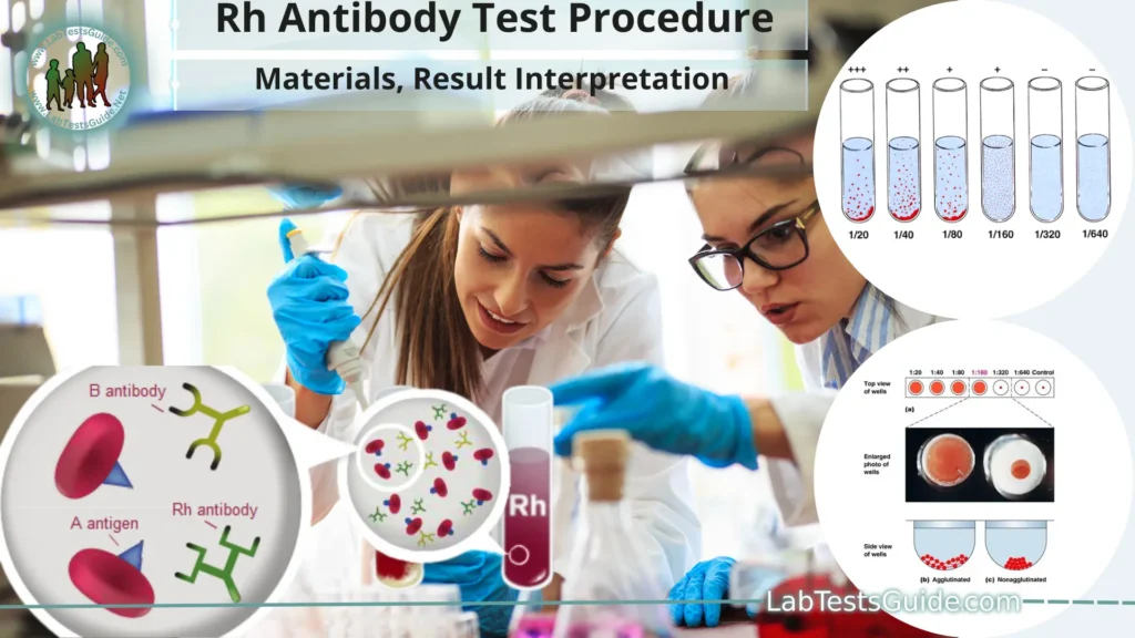 Rh Antibody Titre Test Procedure