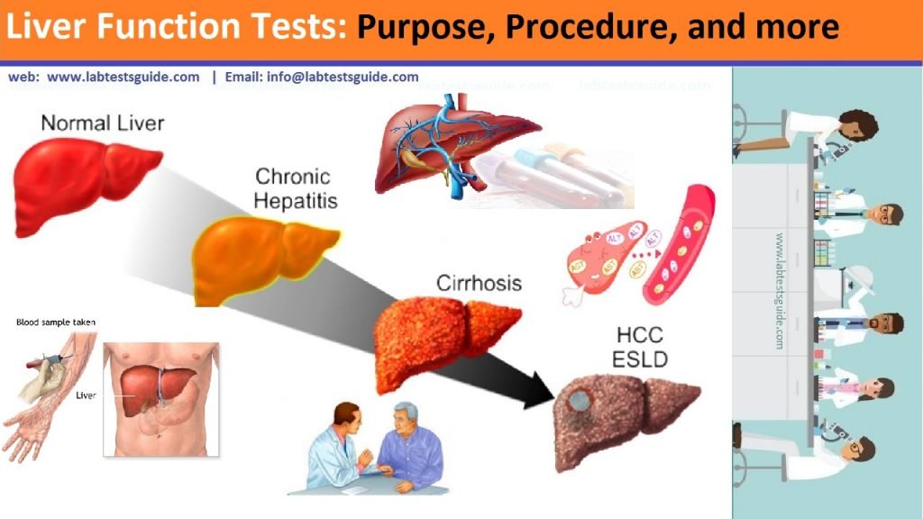 Плохая кровь печень. Liver function. Liver Blood Test. Alt Liver.