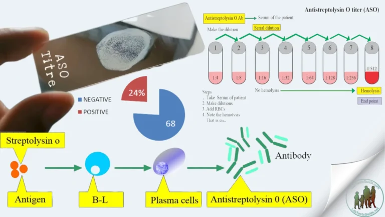 ASO Titer (Antistreptolysin O)
