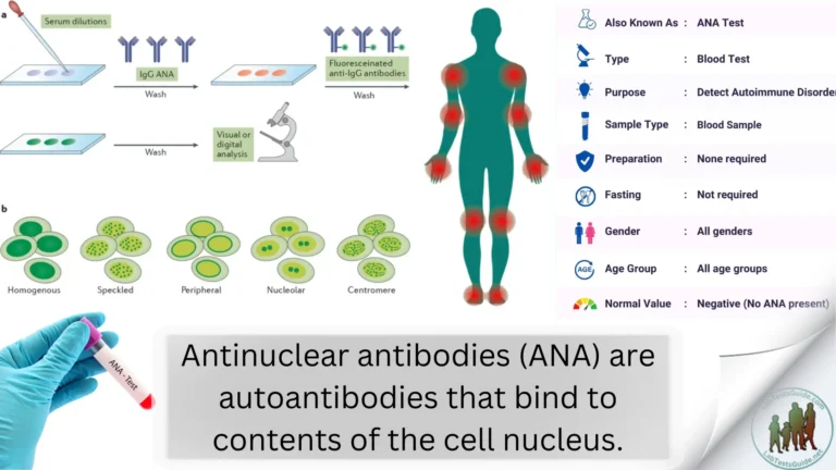 Antinuclear Antibody (ANA)