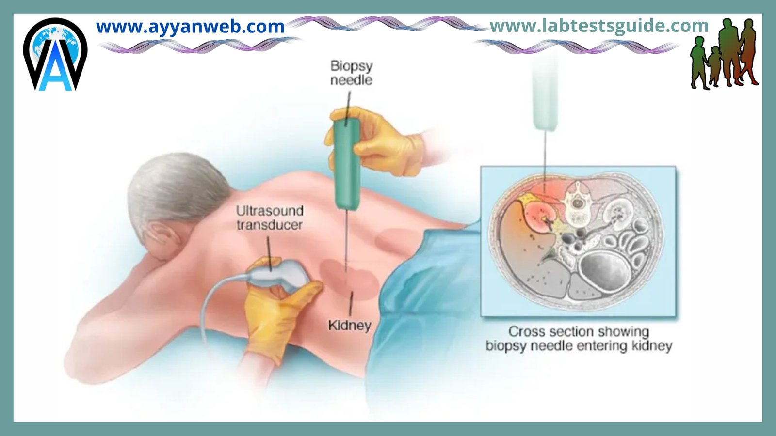 Biopsy | Lab Tests Guide