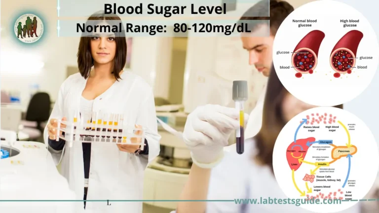 Blood Sugar Level (BSL) Test