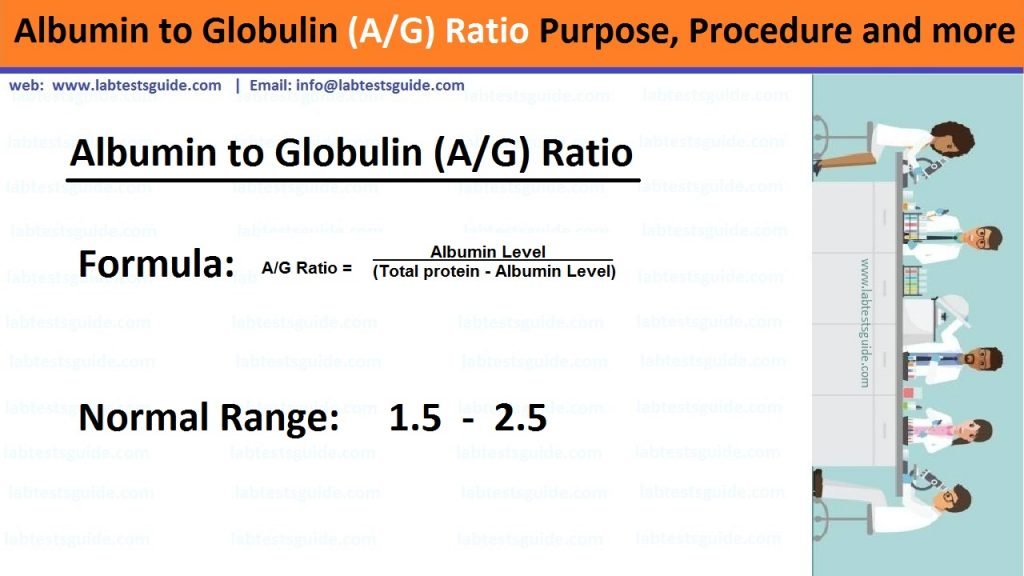 Albumin to Globulin Ratio