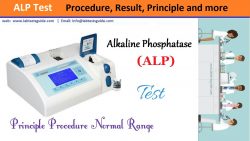 Alkaline Phosphatase Test Procedure