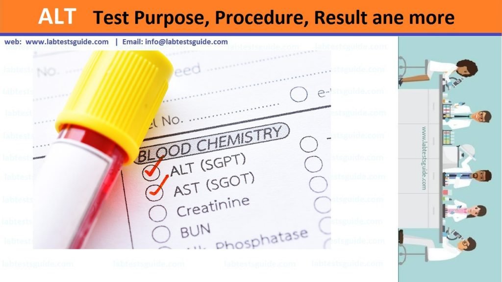 Alanine Aminotransferase (ALT) ALT test