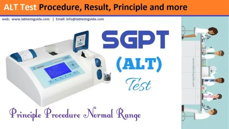ALT Test Procedure