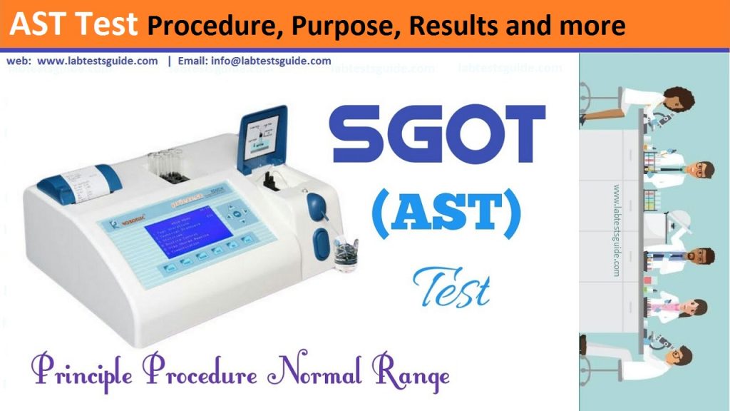 AST Test Procedure