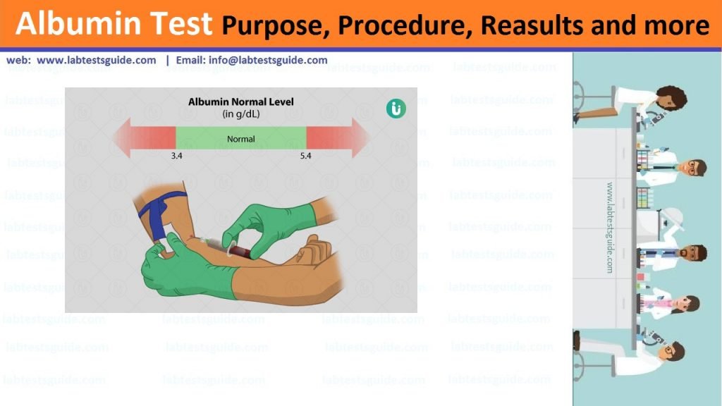 Albumin Test