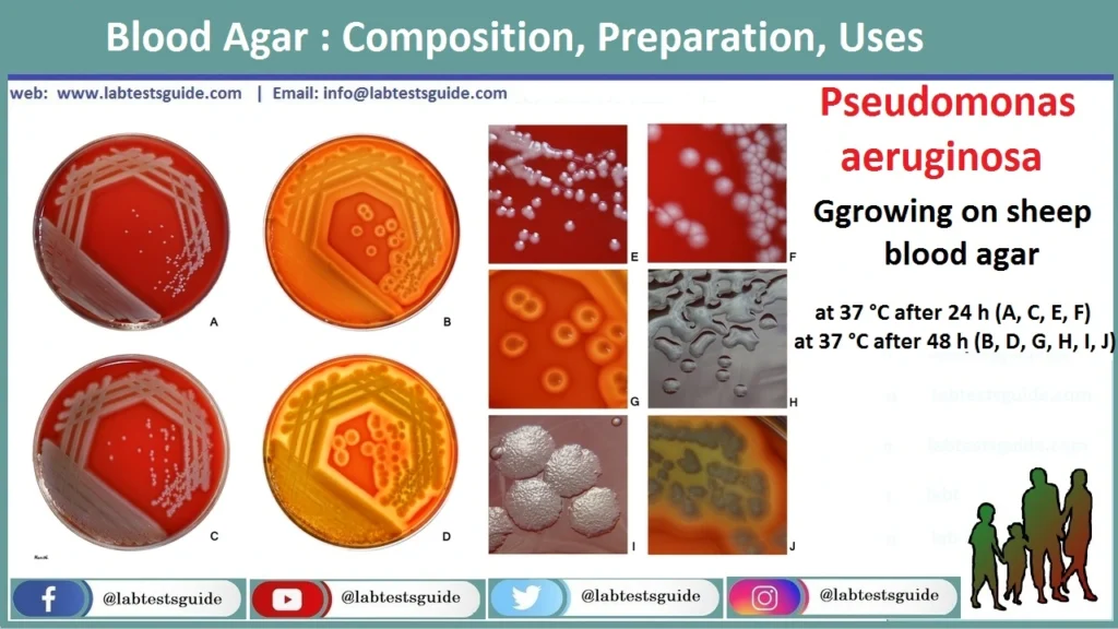 Blood Agar Blood Agar