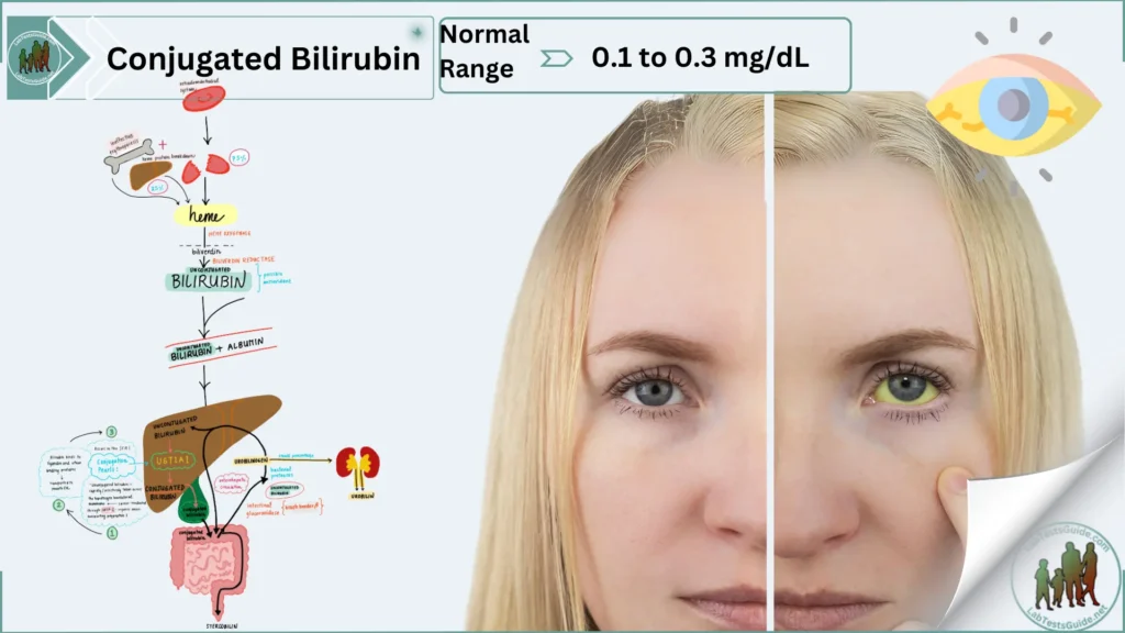 Conjugated Bilirubin Conjugated Bilirubin