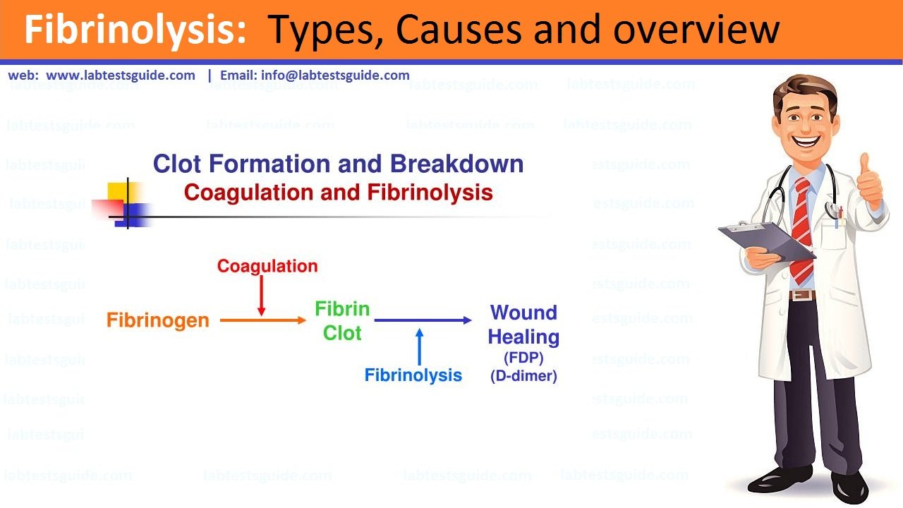 Fibrinolysis Fibrinolysis