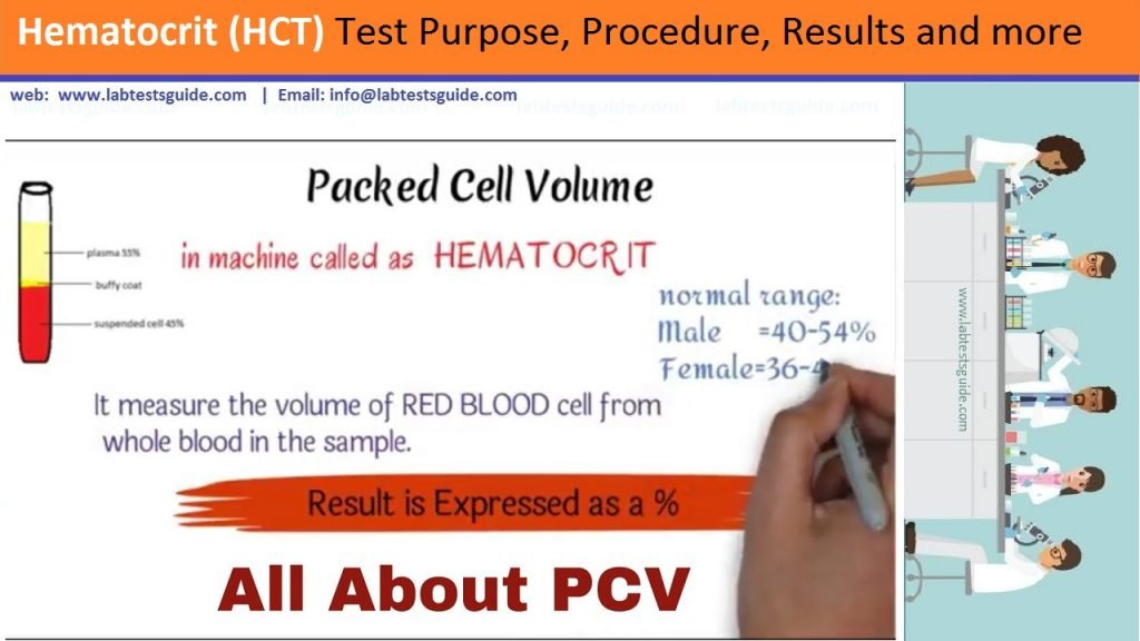 Hematocrit (HCT) HCT Test