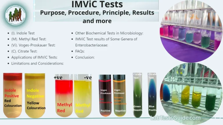 IMViC Tests