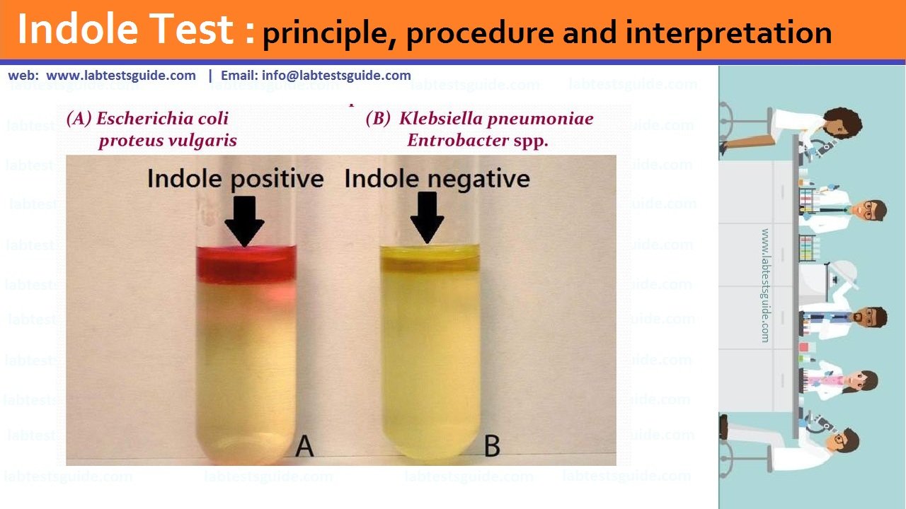 Indole Test Indole Test