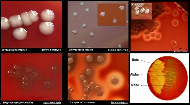 Blood Agar Result Interpretation on Blood Agar