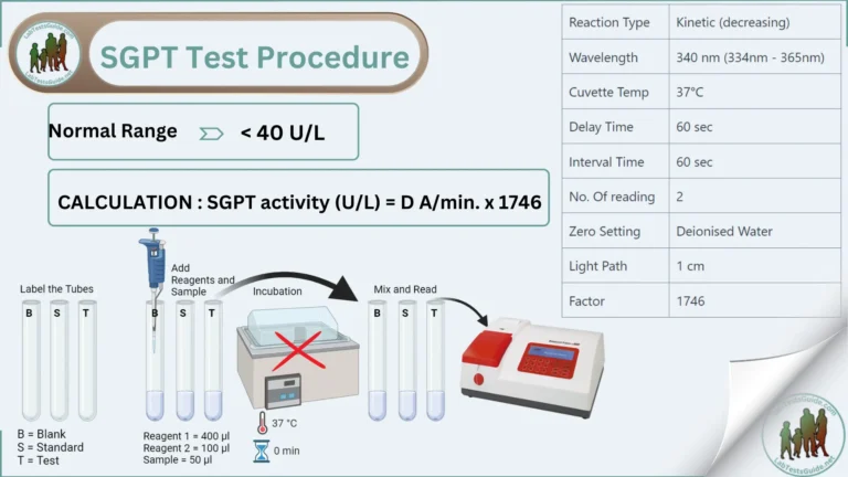 SGPT Test Procedure