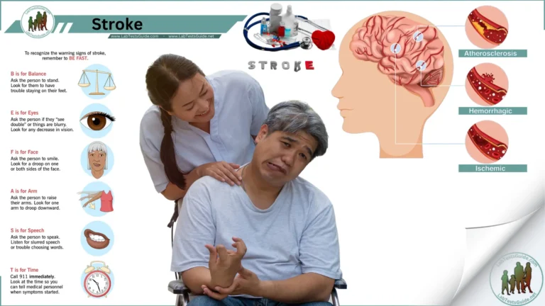 Stroke
