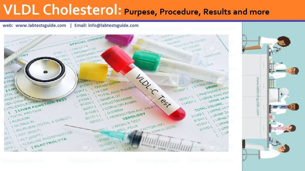 VLDL VLDL Cholesterol