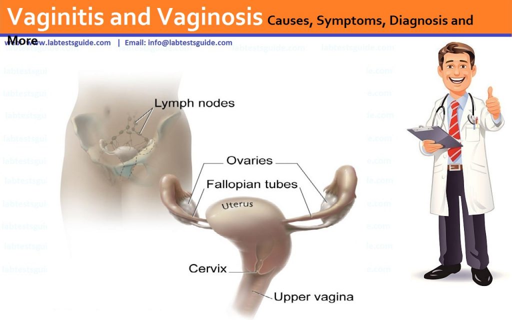 vaginitis and vaginosis