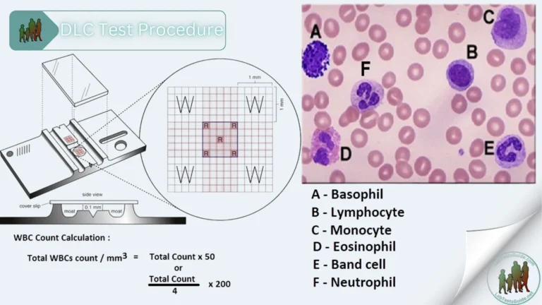 Differential Leukocyte Count (DLC) Test Procedure
