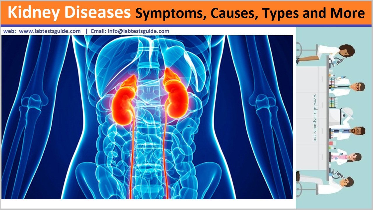 Kidney Diseases