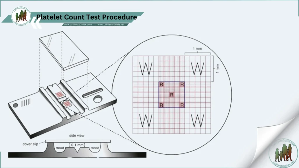 Platelet Count Test Procedure Platelet Count Test Counting Procedure