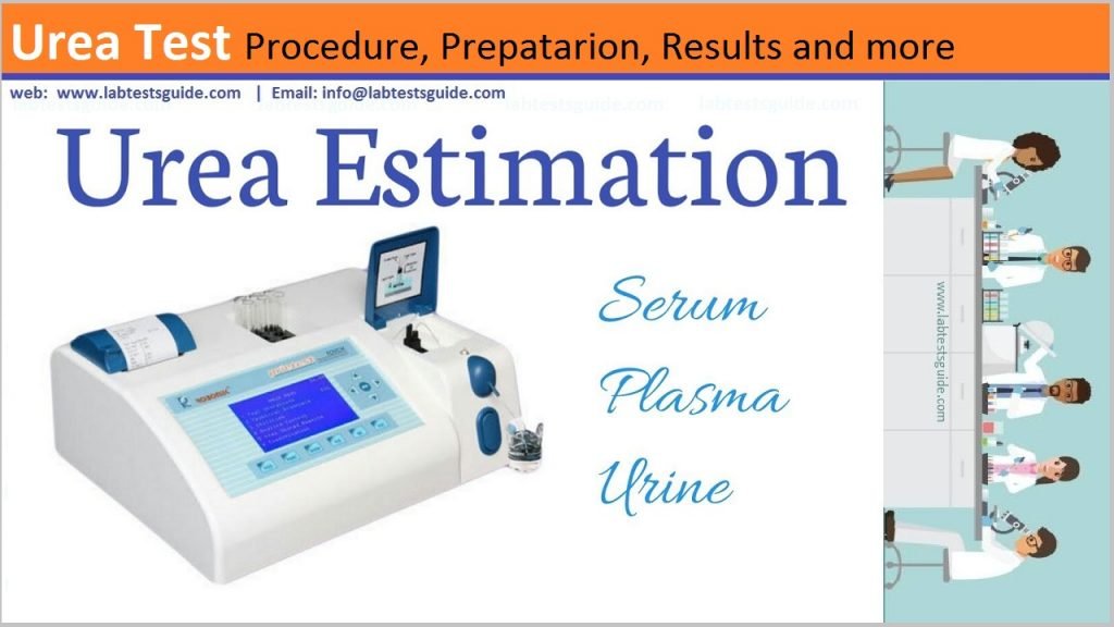 Urea Test Procedure Urea Test Procedure
