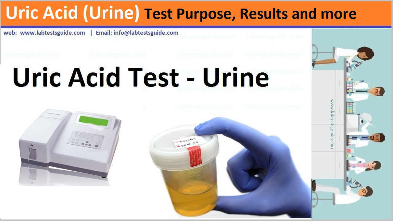 Uric Acid (Urine)