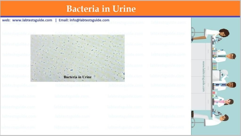 Urine Bacteria