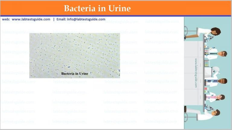 Urine Bacteria