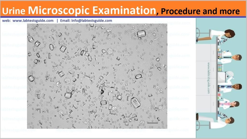 Urine Mocroorganism Urine Microscopic Examination