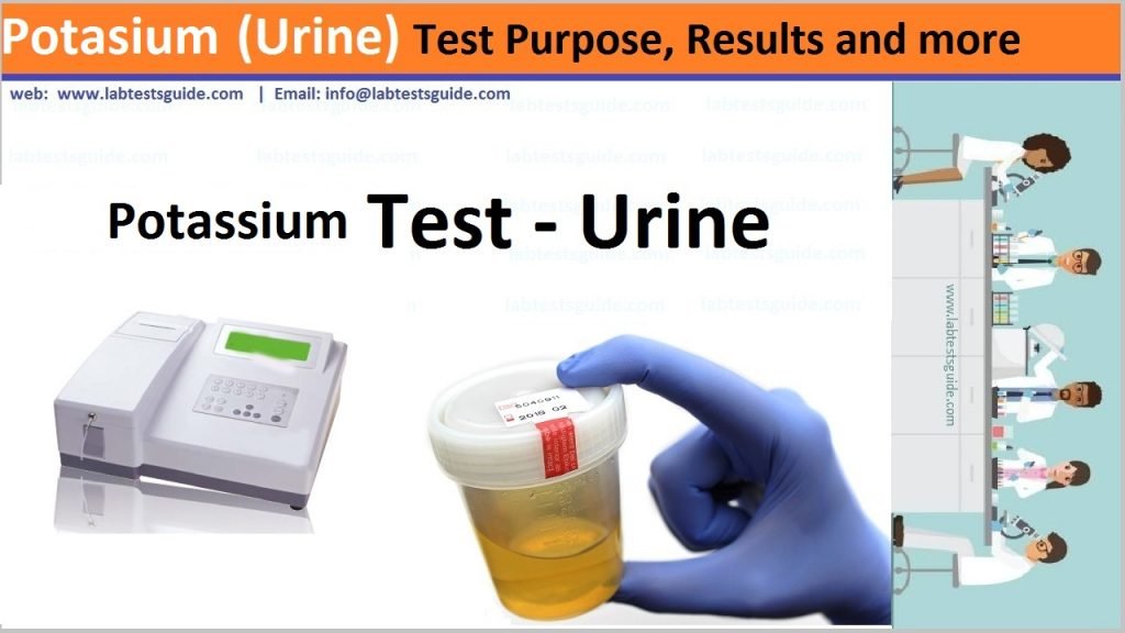 Potassium (Urine) Test Potassium Test in urine