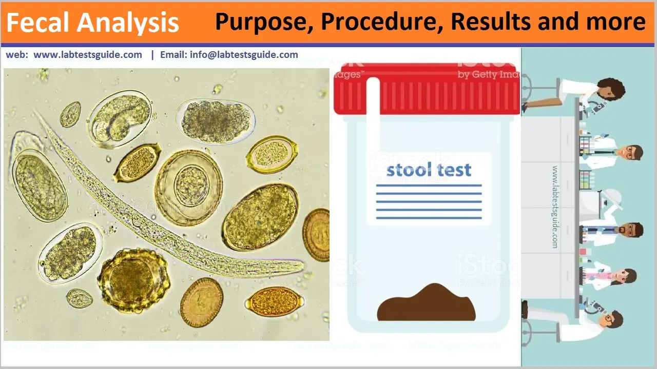 Fecal Analysis Fecal Analysis