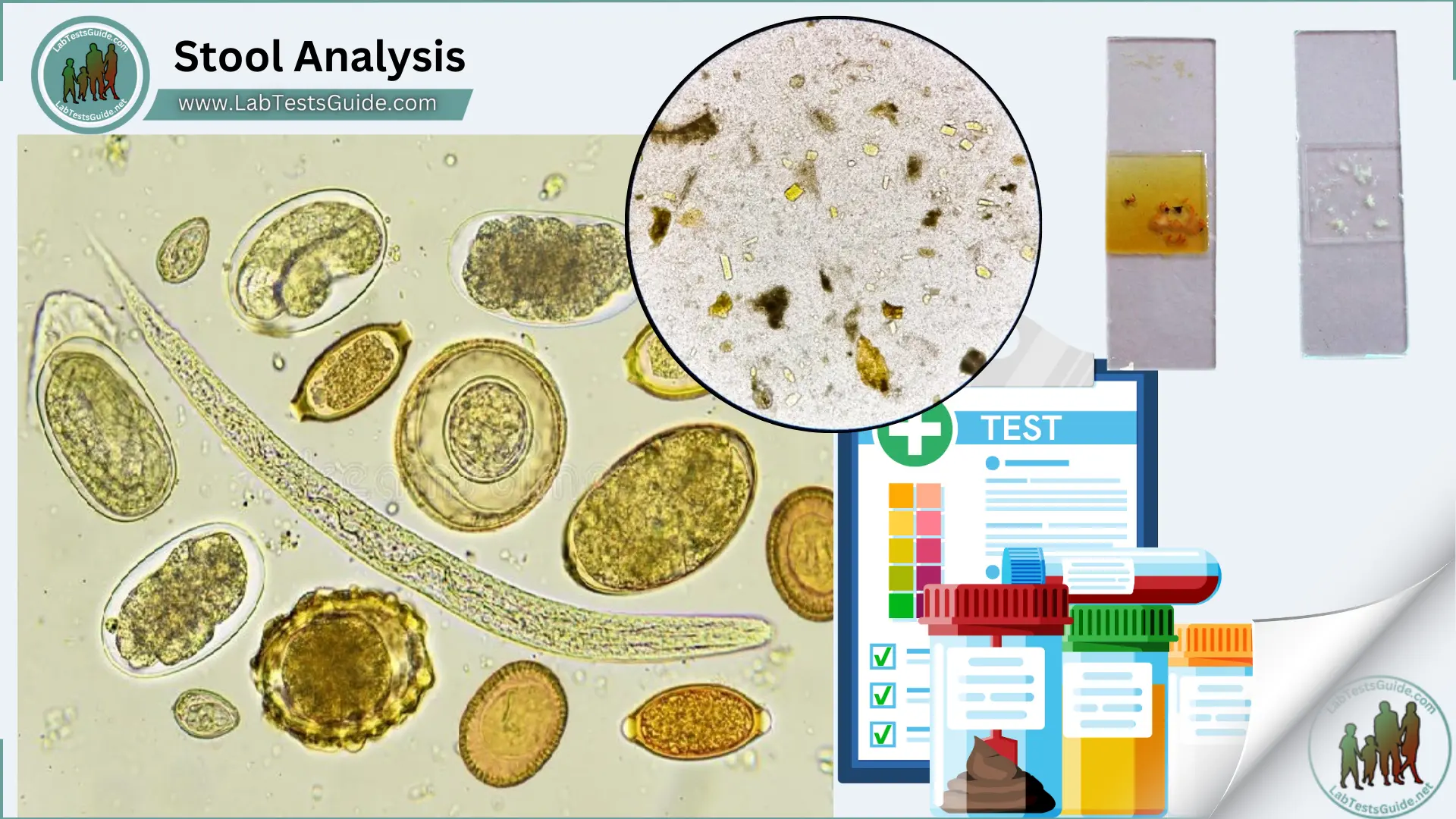 Stool Analysis Stool Analysis