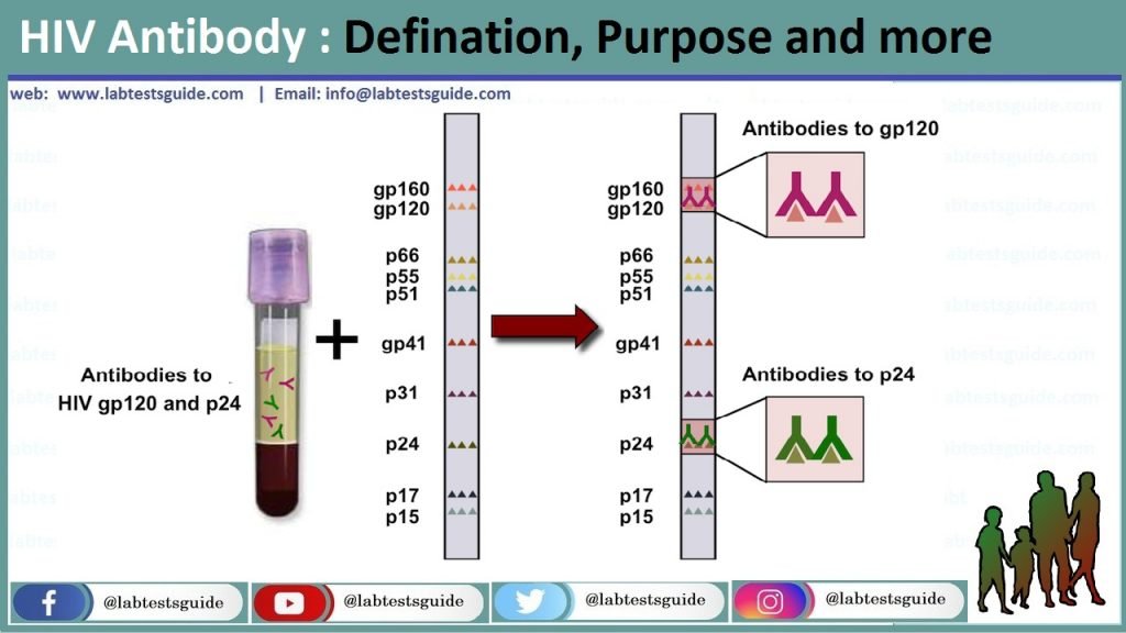 HIV antibody HIV Antibody
