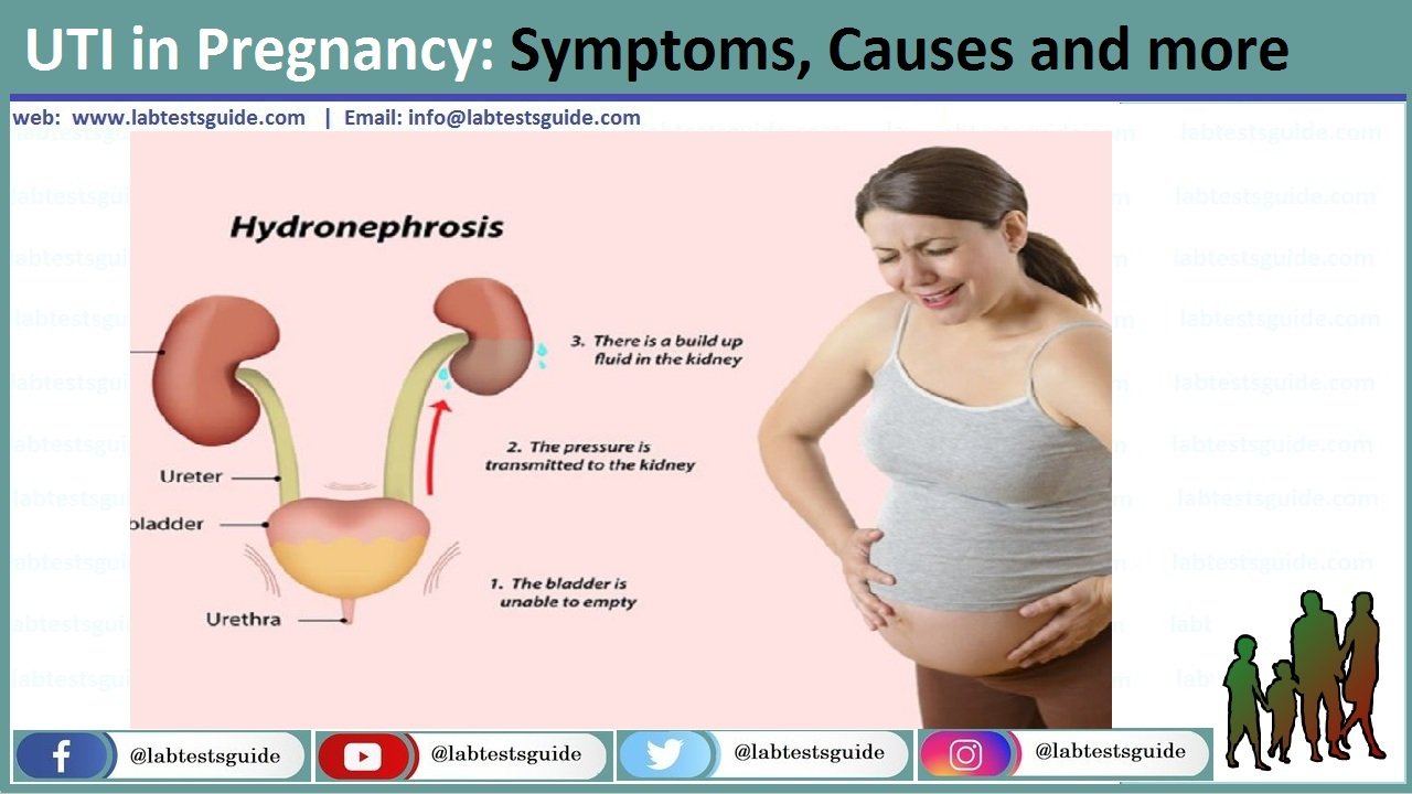 Pregnancy and urinary tract infections (UTIs).