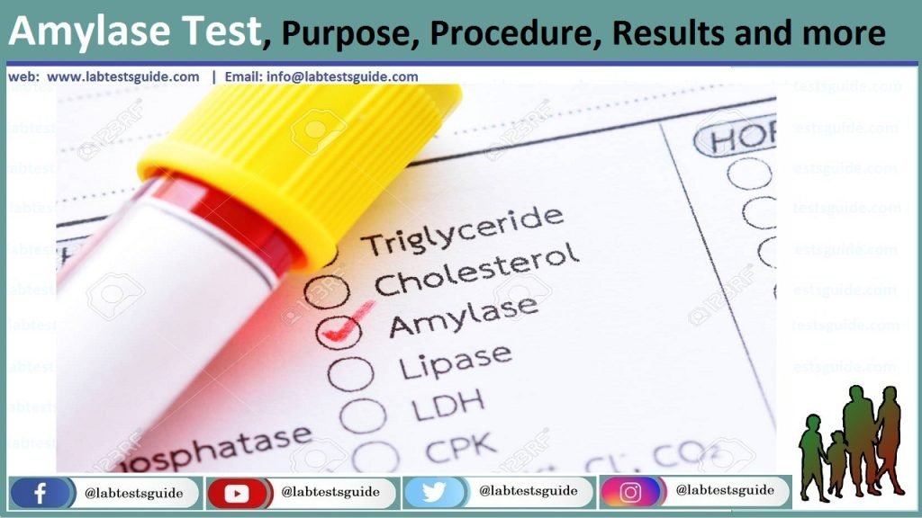 Amylase Serum Test Purpose Procedure Result And More Lab Tests Guide Amylase Serum Test Purpose Procedure Result And More Lab Tests Guide