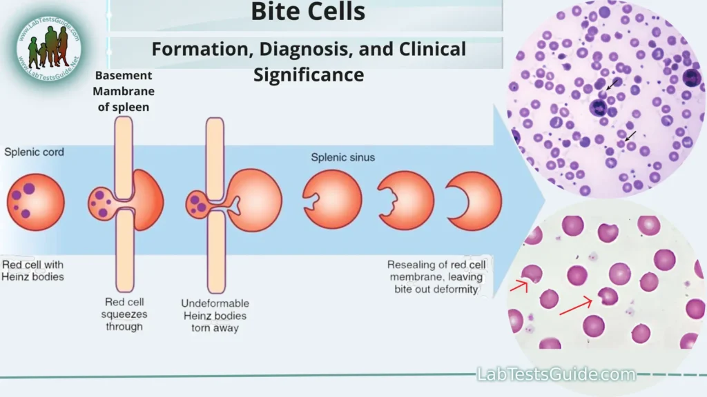Bite Cells Bite Cells