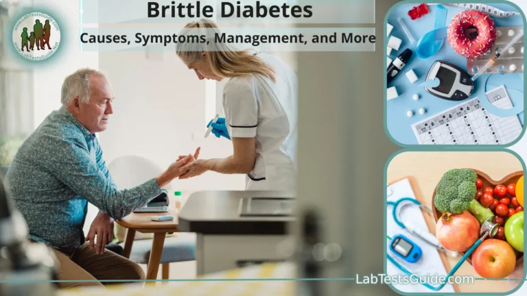 Brittle Diabetes