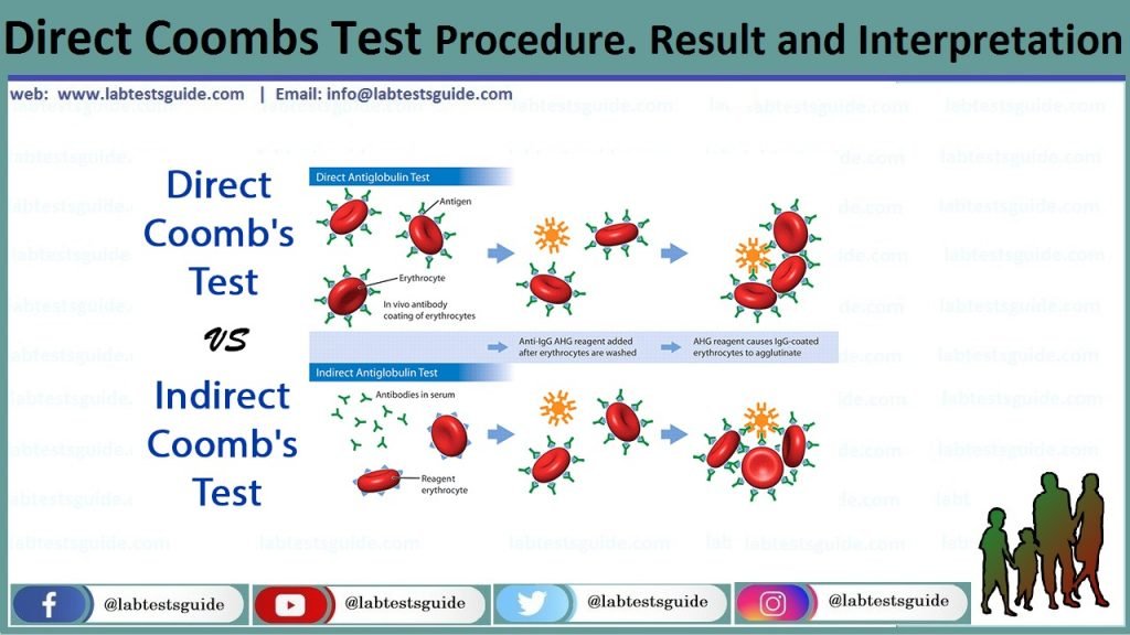 Direct Coombs Test Procedure Direct Coombs Test