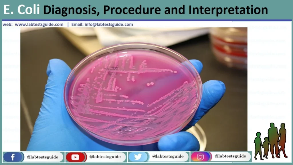 E.-Coli