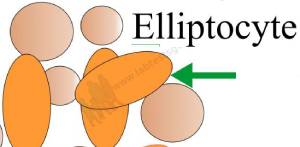 Elliptocytes Cells