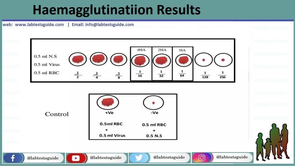 Haemagglutionation Assay (HA) Haemagglutionation Assay (HA) - Haemagglutionation test detect the presence of viral particles and can see visibly and macroscopically. This test does not distinguish between the viral particles which are infectious and these particles are degraded and no longer and capable to infect the cells.