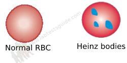 Heinz bodies
